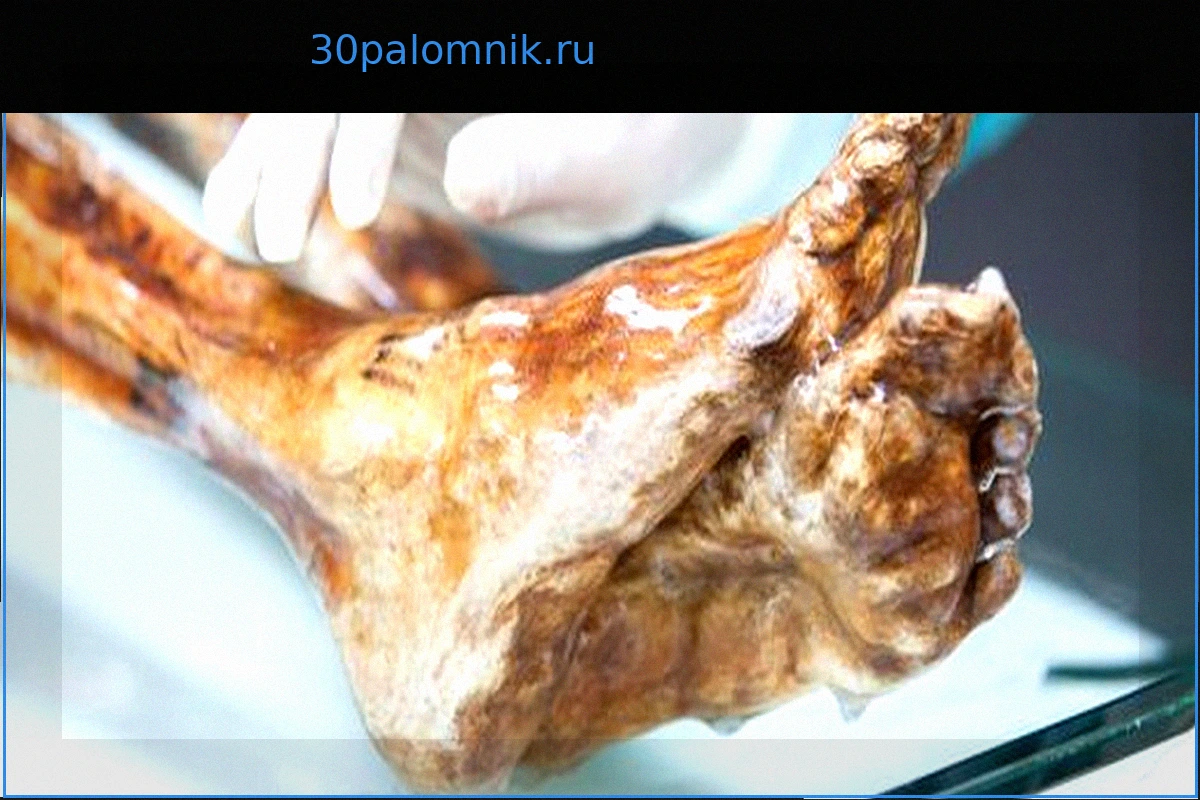 Эци: Угрожает ли знаменитой ледяной мумии разложение?