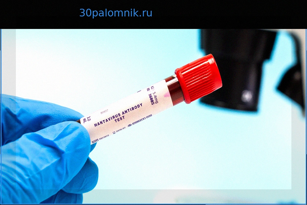 ВОЗ успокаивает общественность после обнаружения хантавируса на круизном лайнере