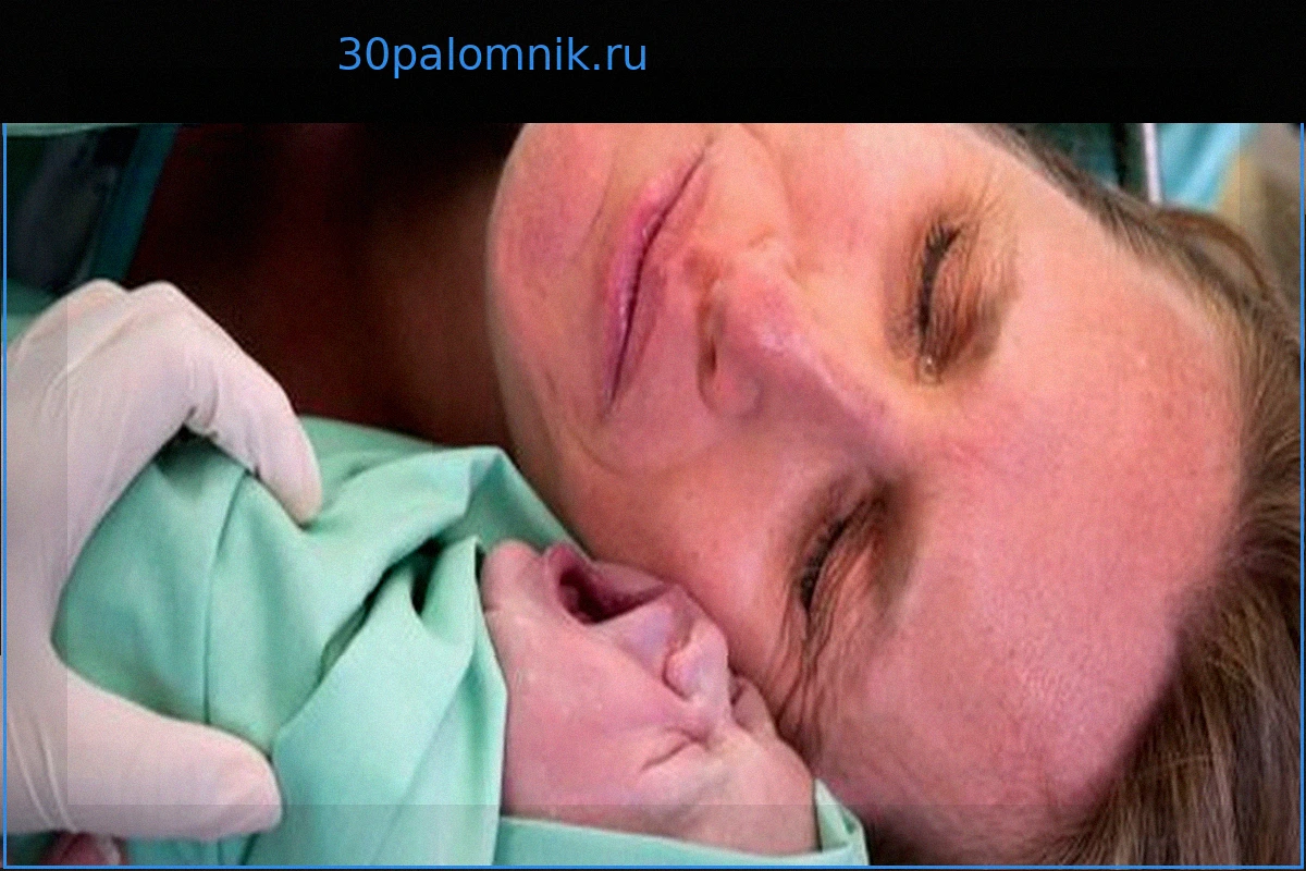 Кесарево сечение: Почему многие женщины испытывают боль, несмотря на анестезию?